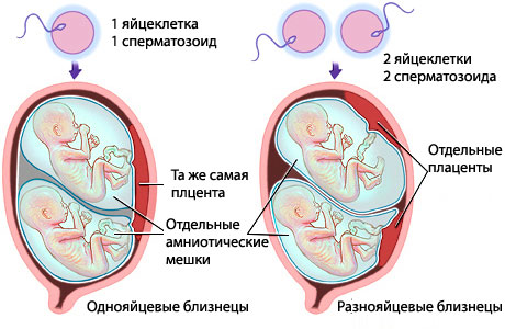 Близнецы и двойняшки: в чем разница